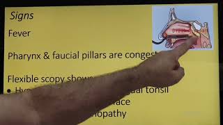 Lingual tonsillitis Malayalam Patient teaching programme [upl. by Noscire643]