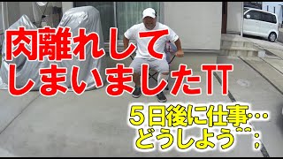 肉離れして３週間まともに歩けないと医師に言われたけど５日で何とかしたいと思ってます！ [upl. by Punak]