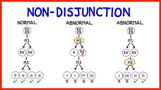 MEIOSIS NON DISJUNCTION AND DOWN SYNDROME GRADE 12 LIFE SCIENCES THUNDEREDUC MSAIDI [upl. by Ived]