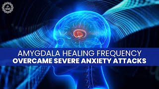 Amygdala Healing Frequency  Rewiring The Anxious Brain  Overcame Severe Anxiety Attacks  Heal [upl. by Emelita634]