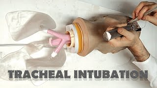 Tracheal tube placement  INTUBATION [upl. by Comfort123]