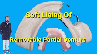 How to make soft liner Removable partial dentur  Soft Liner RPD by Haider [upl. by Lusa]