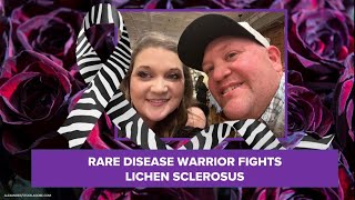 I want to save lives Breaking the silence about Lichen Sclerosus [upl. by Lissie]