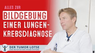 Diagnose Lungenkrebs welche Bildgebung wird gemacht [upl. by Sonitnatsnok]