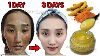 Magical Turmeric Cream  In 3 days it removes pigmentation dark spots freckles and treats melasma [upl. by Diana633]