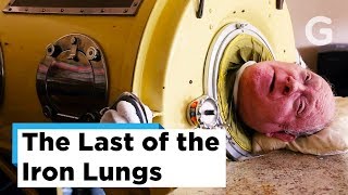 The Last Few Polio Survivors – Last of the Iron Lungs  Gizmodo [upl. by Ydneh]