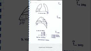 Épanchement pleural et ponction pleurale [upl. by Aiset]