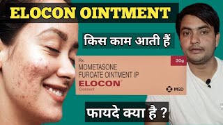 elocon ointment cream uses in hindi  elocon ointment cream [upl. by Alameda]