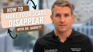 How To Make Your Scars Disappear  Barrett Plastic Surgery [upl. by Santos145]