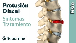 Protrusión de disco o discal  Qué es causas síntomas y tratamiento [upl. by Grega923]