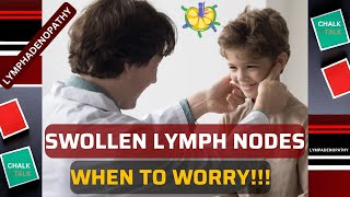 SWOLLEN LYMPH NODES LYMPHADENOPATHY [upl. by Adnorehs]