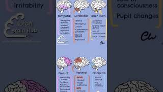 Brain Lobes brain anatomy science [upl. by Navac]