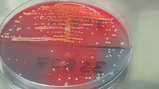 Staphylococcus saprophyticus colony morphology on CLED agar [upl. by Remy921]