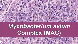 Mycobacterium avium complex MAC [upl. by Tennek]