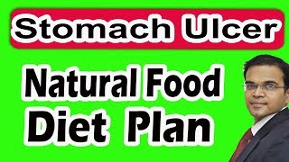 Stomach 🥑Gastric Ulcer 15 Natural Diet Plan Tips வயிறு அல்சர் புண் உடனே குணமடைய சரியாக 15 உணவு [upl. by Tsan]