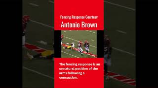 Fencing Response Courtesy Antonio Brown [upl. by Kirby]