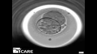 Time Lapse Embryo Imaging [upl. by Assilanna]