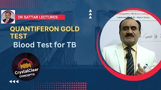 Quantiferon Gold TB Test  A Blood Serum test for TB Diagnosis [upl. by Zima749]