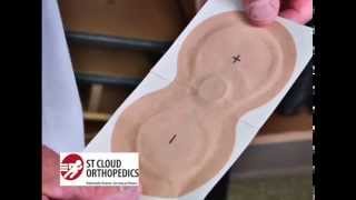 St Cloud Orthopedics  Iontophoresis Medicine Patch [upl. by Vickey]