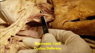 INGUINAL CANAL and Abdominal Ventral HERNIAS – Sanjoy Sanyal [upl. by Euphemie]