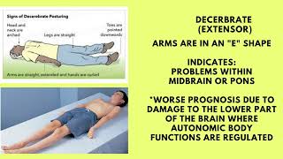 TBI Posturing Decerebrate vs Decorticate [upl. by Duong657]