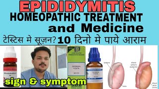 Epididymitis symptoms cause and cured by homeopathic medicineअंडकोष में दर्द और सूजन को ठीक करे [upl. by Arbmat579]