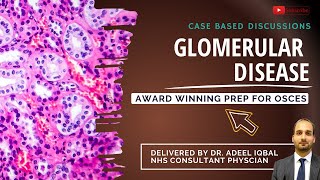 Glomerular Disease  Abdominal  BEST OSCE Preparation for Medical Student Exams [upl. by Eeimaj]