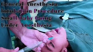 General Anesthesia Intubation Procedure  Small Baby Going Under Anesthesia  Anesthetic Waseem [upl. by Anilesor797]