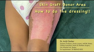 Skin graft donor area How to do the dressing [upl. by Jahdal790]