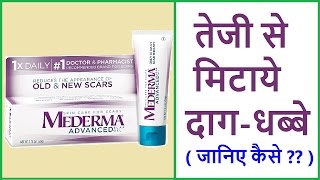 चेचक के दाग व पिंपल और चोट के निशान मिटाने का सबसे आसान तरीका  Remove chickenpox Scars [upl. by Scriven526]