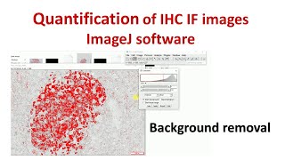 Quantification of Immunohistochemistry images using ImageJ  How to remove background in ImageJ [upl. by Ellenad]