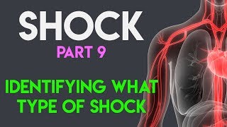 Identifying What Type Shock  Shock Part 9 [upl. by Eduam]