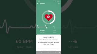 Heart monitor 10 minutes after being Zapped [upl. by Boucher]