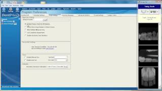 Changing the Clinical Charting Screen  DentiMax Dental Software Tip [upl. by Larkins770]