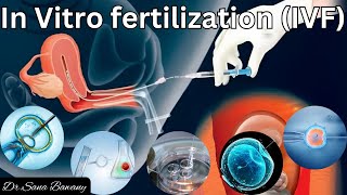 IVF Complete Process Step By Step  In Vitro Fertilization Procedure [upl. by Gant]