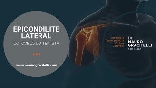 🚨INCRÍVEL🚨EPICONDILITE LATERAL RESOLVENDO EM 5 MINUTOS [upl. by Pacian]