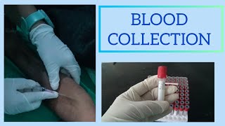 EASY WAY TO DRAW BLOOD।। BLOOD SAMPLE PROCEDURE ।। HOW TO TAKE BLOOD FROM VEIN ।। [upl. by Halden958]