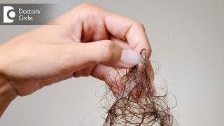 What are causes of severe hair fall like 100 strands daily  Dr Nischal K [upl. by Thorfinn]