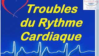 Troubles du rythme cardiaque chez lHypertendu [upl. by Sheply]