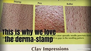 Dermapen Dermaroller DermaStamp HELP HELP [upl. by Hirza907]