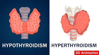 Hypothyroidism vs Hyperthyroidism Explained thyroid [upl. by Ange]