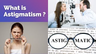 What is Astigmatism  Astigmatism symptoms Astigmatism causes Astigmatism diagnosis and treatment [upl. by Andrien342]