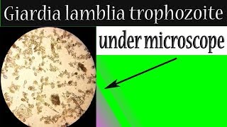 Giardia lamblia trophozoite under microscope In stool sample [upl. by Rowley]