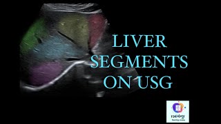 LIVER SEGMENTS ON ULTRASOUNDl Coinaud segmentsl Liver ultrasound procedure for full liver screening [upl. by Tandie]