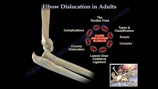 Elbow Dislocation In Adults  Everything You Need To Know  Dr Nabil Ebraheim [upl. by Assirem]