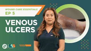 Wound Care Essentials Video 5 – Venous Ulcers [upl. by Assilak]