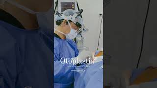 OTOPLASTIA [upl. by Trakas341]