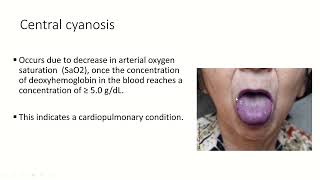 Cyanotic Congenital Heart Disease En  Soha Romeih [upl. by Pendergast]