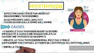 Lhypothyroidie thyroidite de HASHIMOTO [upl. by Marc]