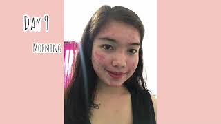 SKINCAREBRILLIANT SET 15 days of using BRILLANT SKIN REJUVENATING SET honest Review [upl. by Graig]